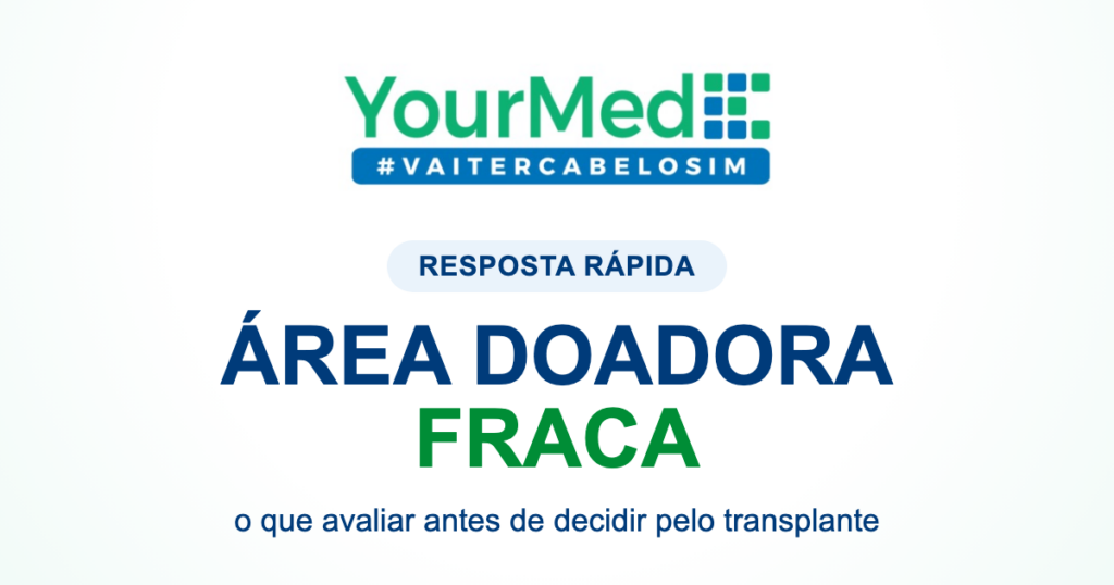 Área doadora fraca: ainda posso fazer transplante? | resposta rápida YourMed