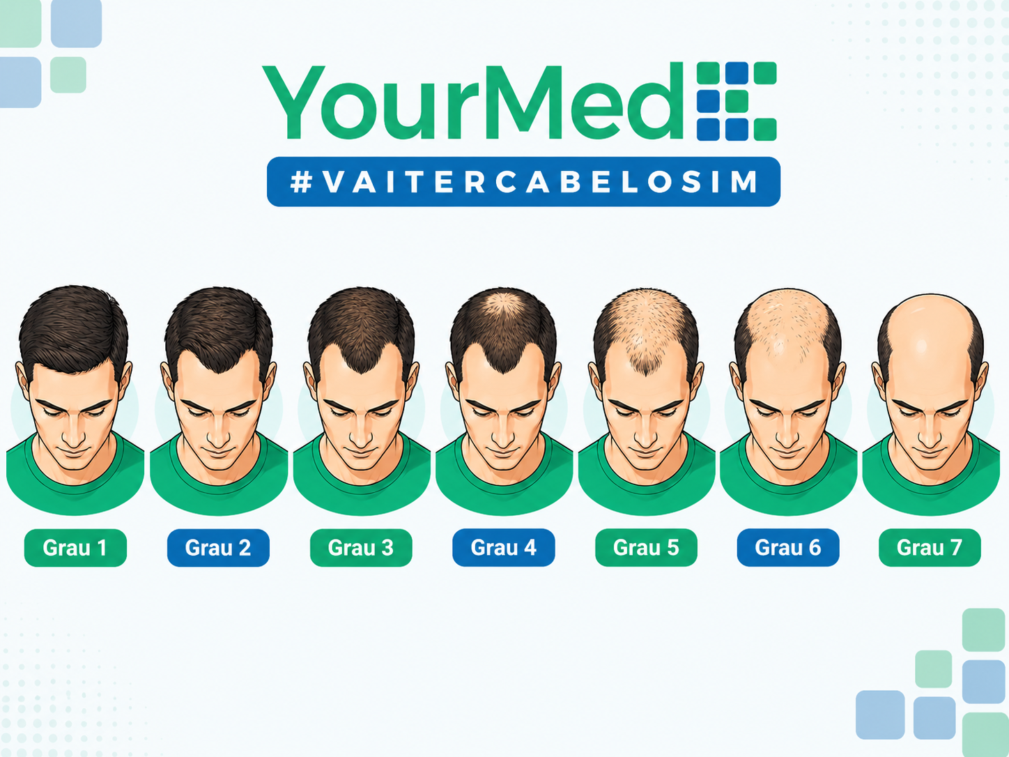 Escala visual de graus de calvície YourMed VaiTerCabeloSim para avaliar entradas no cabelo e transplante capilar