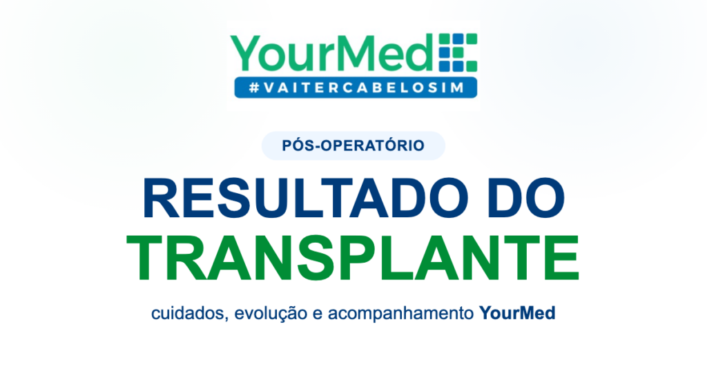 Imagem de destaque YourMed sobre Pós Operatório de Transplante Capilar: Um Guia Completo da YourMed para uma Recuperação Bem-Sucedida