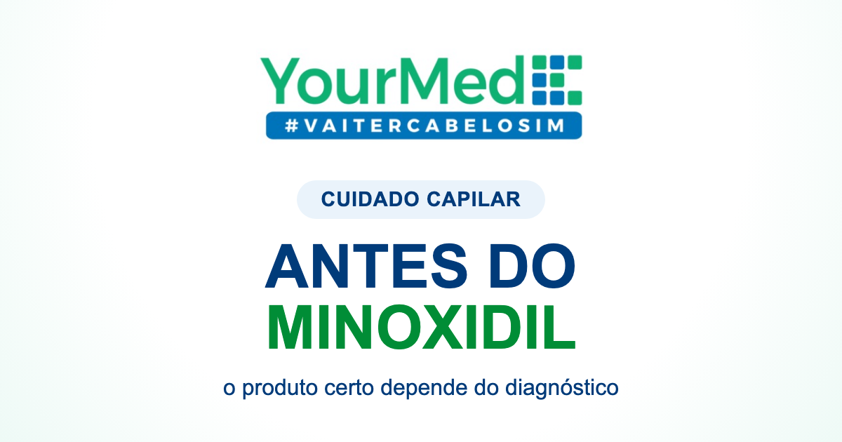 Antes de comprar minoxidil: o que você precisa avaliar? | YourMed VaiTerCabeloSim