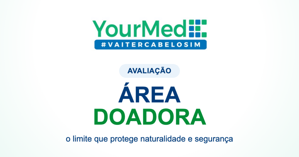 Área doadora no transplante capilar: por que ela decide o resultado? | YourMed VaiTerCabeloSim