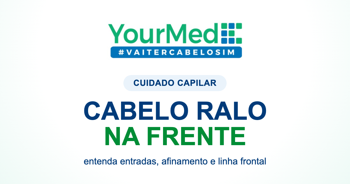 Cabelo ralo na frente: o que pode ser e quando tratar? | YourMed VaiTerCabeloSim