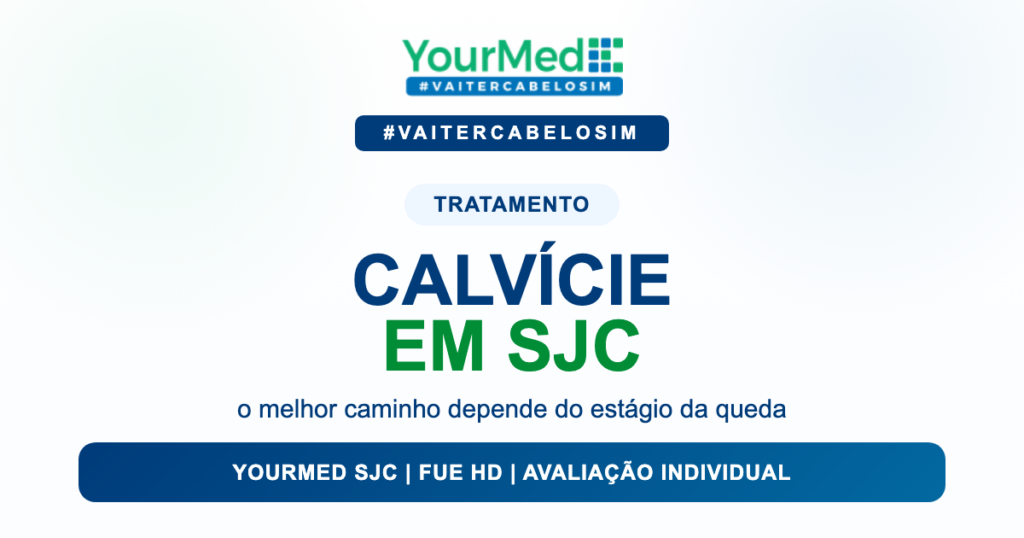 Calvície em São José dos Campos: tratamento, AMD ou transplante capilar? | YourMed São José dos Campos