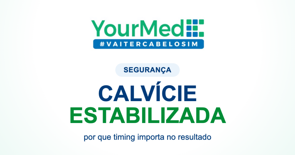 Calvície estabilizada: por que isso importa antes do transplante capilar? | YourMed VaiTerCabeloSim