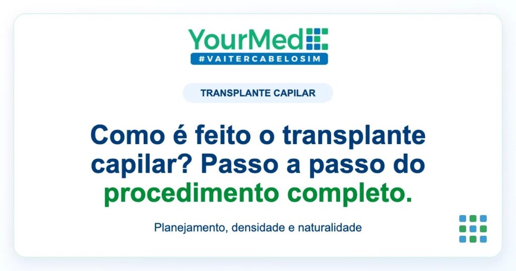 Imagem de destaque YourMed sobre Como é feito o transplante capilar? Passo a passo do procedimento completo.
