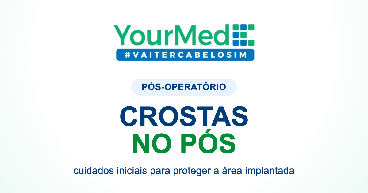 Crostas depois do transplante capilar: o que fazer nos primeiros dias? | YourMed VaiTerCabeloSim