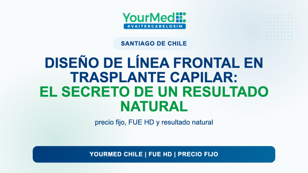 Diseño de línea frontal en trasplante capilar: el secreto de un resultado natural | YourMed Chile FUE HD