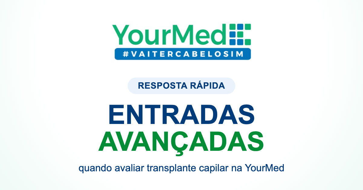 Entradas avançadas: quando o transplante capilar deve ser avaliado? | YourMed VaiTerCabeloSim