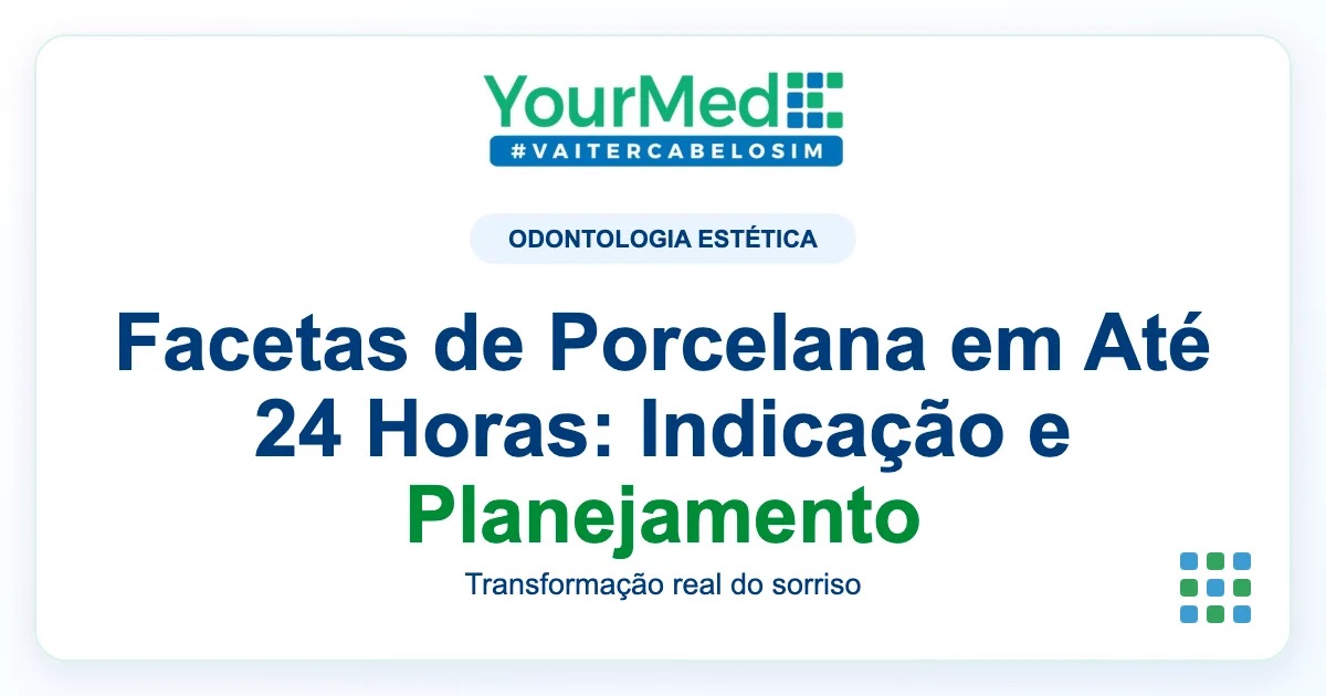 Imagem de destaque YourMed sobre Facetas de Porcelana em Até 24 Horas: Indicação e Planejamento