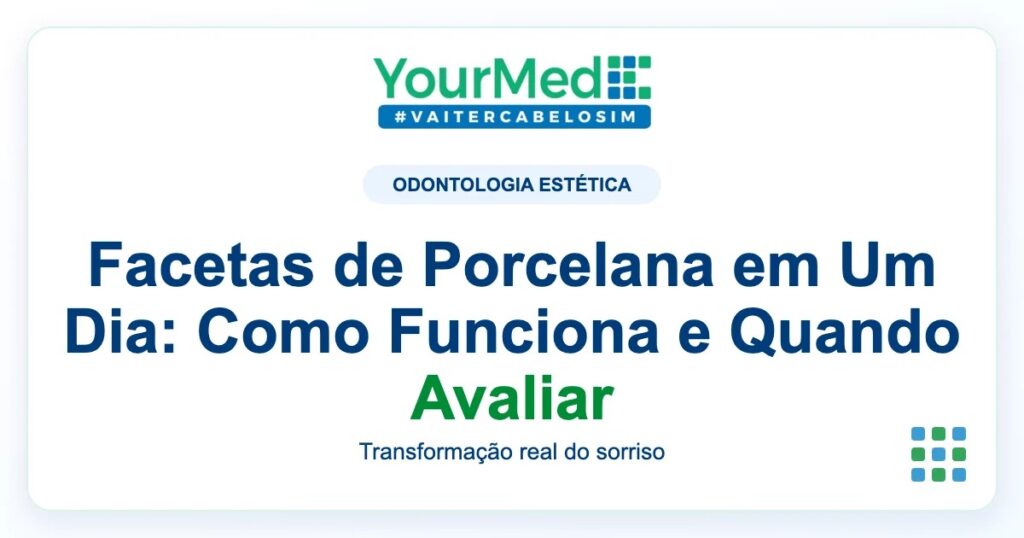 Imagem de destaque YourMed sobre Facetas de Porcelana em Um Dia: Como Funciona e Quando Avaliar
