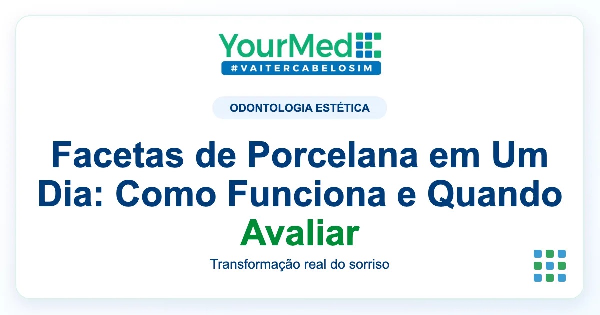 Imagem de destaque YourMed sobre Facetas de Porcelana em Um Dia: Como Funciona e Quando Avaliar