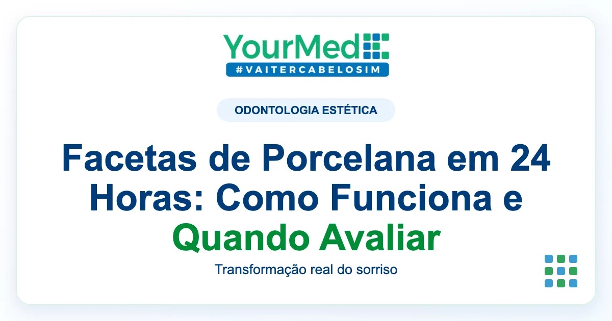 Imagem de destaque YourMed sobre Facetas de Porcelana em 24 Horas: Como Funciona e Quando Avaliar