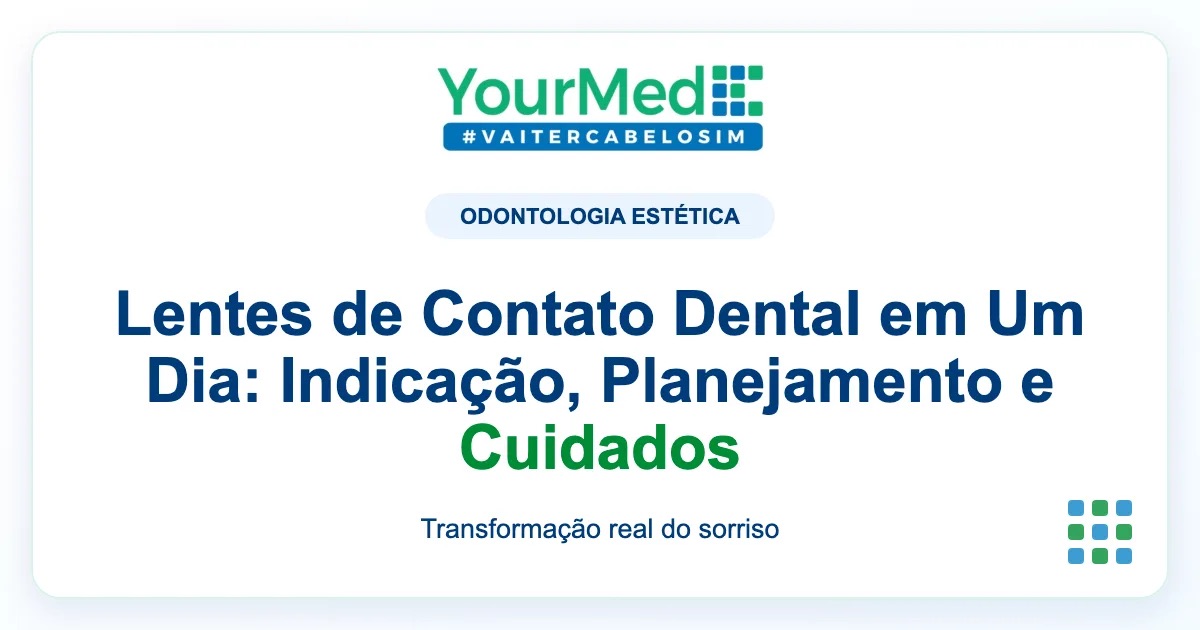 Imagem de destaque YourMed sobre Lentes de Contato Dental em Um Dia: Indicação, Planejamento e Cuidados