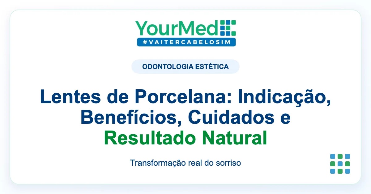 Imagem de destaque YourMed sobre Lentes de Porcelana: Indicação, Benefícios, Cuidados e Resultado Natural