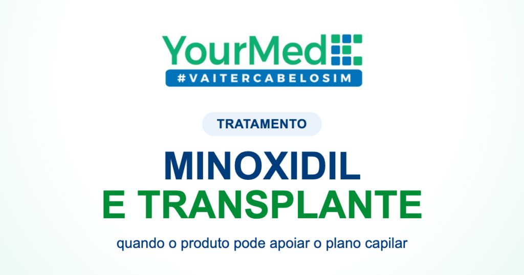 Minoxidil antes ou depois do transplante capilar: quando pode entrar no plano? | YourMed VaiTerCabeloSim