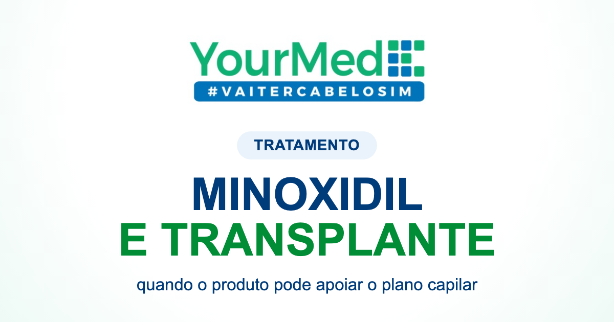 Minoxidil antes ou depois do transplante capilar: quando pode entrar no plano? | YourMed VaiTerCabeloSim