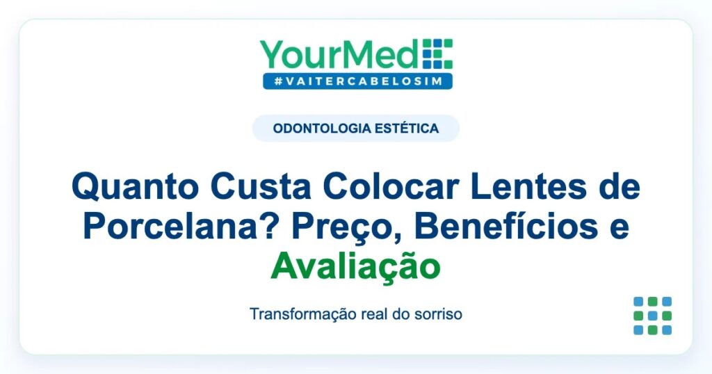 Imagem de destaque YourMed sobre Quanto Custa Colocar Lentes de Porcelana? Preço, Benefícios e Avaliação