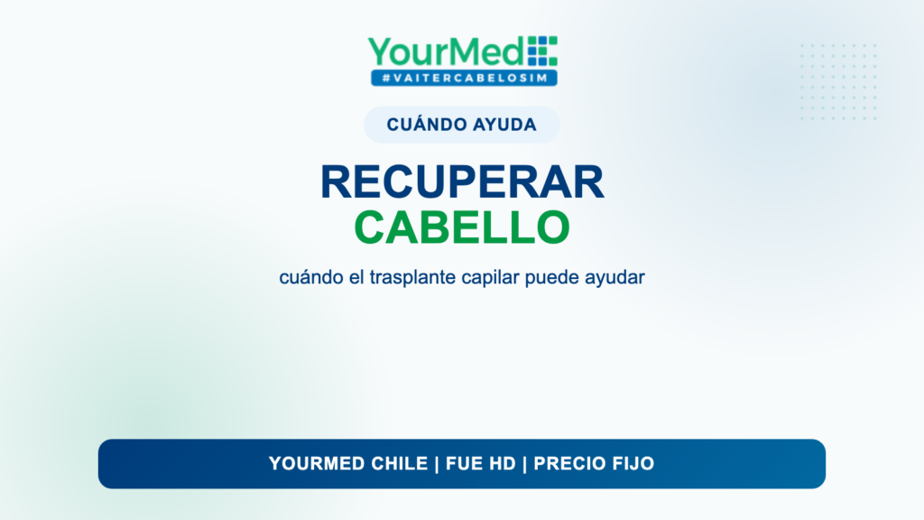 Recuperar el cabello en Santiago de Chile: cuándo el trasplante capilar puede ayudar | YourMed Chile FUE HD
