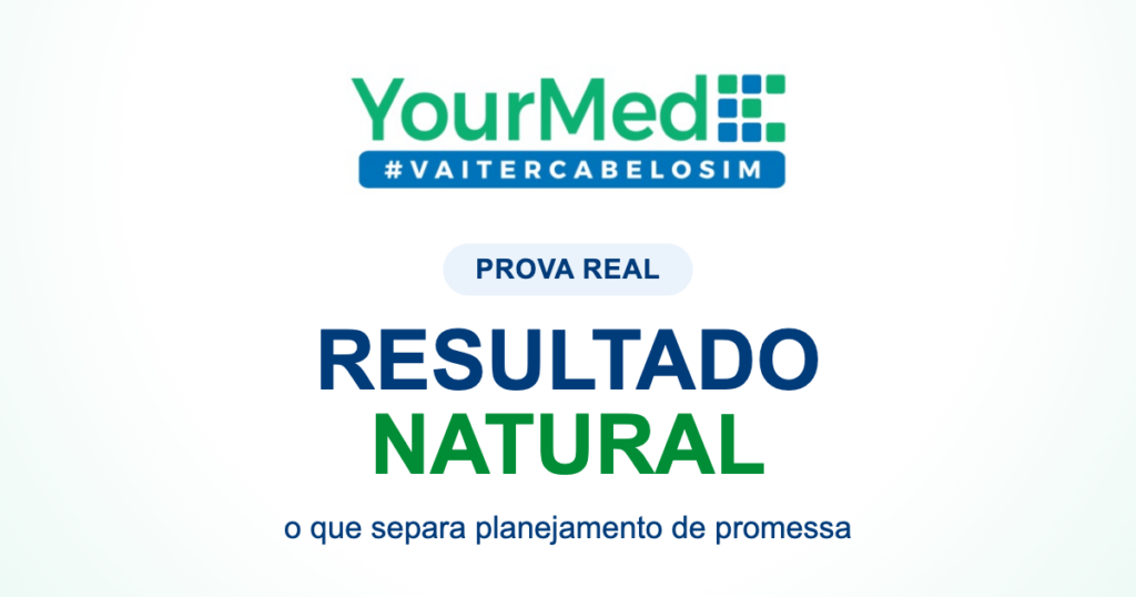 Resultado natural no transplante capilar: sinais de um bom planejamento | YourMed VaiTerCabeloSim