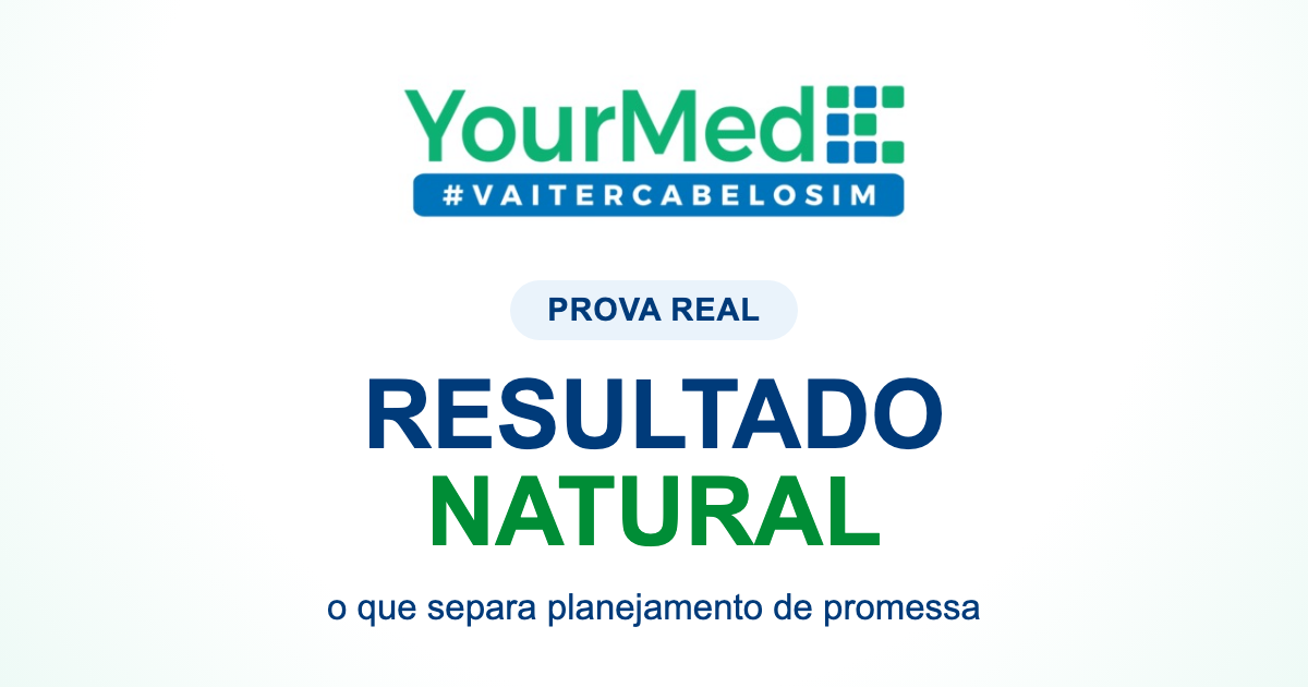 Resultado natural no transplante capilar: sinais de um bom planejamento | YourMed VaiTerCabeloSim