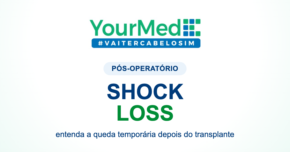 Shock loss após transplante capilar: é normal perder fios? | YourMed VaiTerCabeloSim