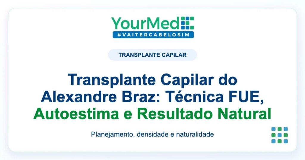 Imagem de destaque YourMed sobre Transplante Capilar do Alexandre Braz: Técnica FUE, Autoestima e Resultado Natural