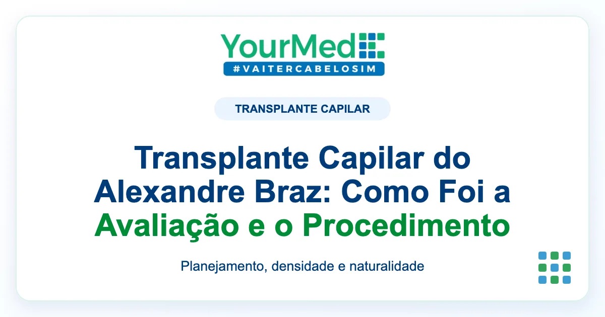 Imagem de destaque YourMed sobre Transplante Capilar do Alexandre Braz: Como Foi a Avaliação e o Procedimento