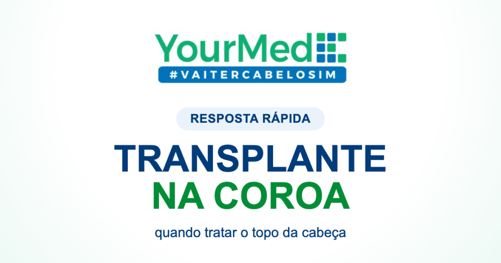 Transplante capilar na coroa: quando faz sentido tratar o topo da cabeça? | YourMed VaiTerCabeloSim